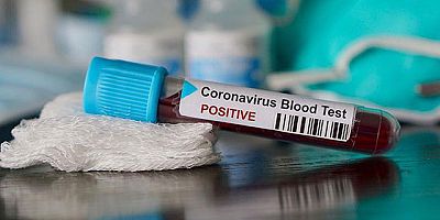 ABD’de koronavirüsten ölenlerin sayısı 215 bin 127’ye ulaştı